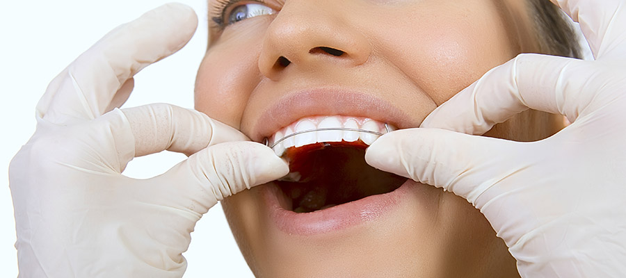 xceptional-dental-SERVICE-conditions-1