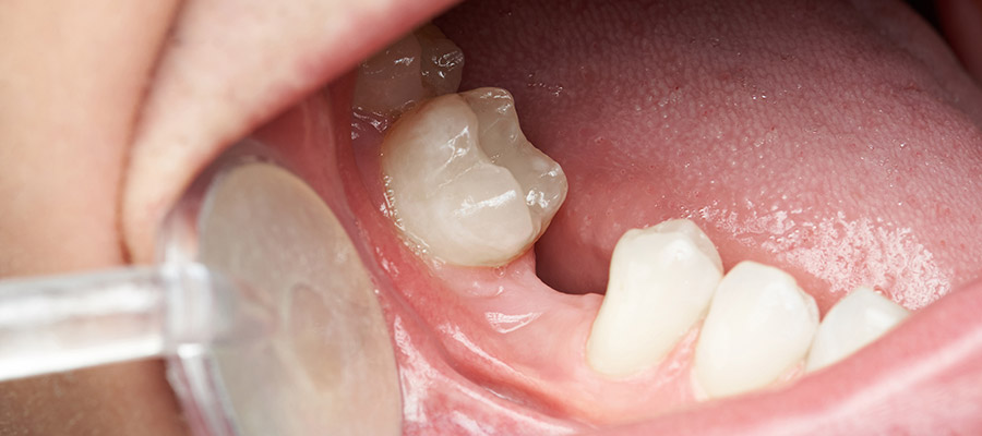 xceptional-dental-SERVICE-conditions-18